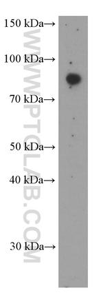 SDCCAG8 Antibody in Western Blot (WB)