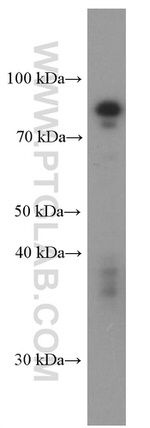 SDCCAG8 Antibody in Western Blot (WB)