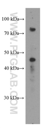 SDCCAG8 Antibody in Western Blot (WB)