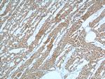 MYL3 Antibody in Immunohistochemistry (Paraffin) (IHC (P))