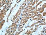 MYL3 Antibody in Immunohistochemistry (Paraffin) (IHC (P))