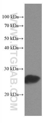 MYL3 Antibody in Western Blot (WB)