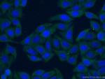 LDHA Antibody in Immunocytochemistry (ICC/IF)