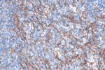 VCAM-1 Antibody in Immunohistochemistry (Paraffin) (IHC (P))