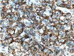 CD19 Antibody in Immunohistochemistry (Paraffin) (IHC (P))