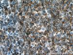 CD19 Antibody in Immunohistochemistry (Paraffin) (IHC (P))