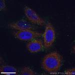 LAMP2 Antibody in Immunocytochemistry (ICC/IF)