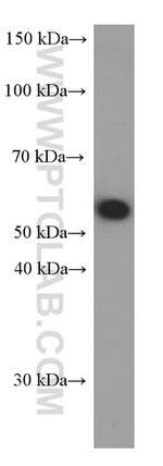 CD47 Antibody in Western Blot (WB)