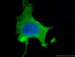 Vinculin Antibody in Immunocytochemistry (ICC/IF)