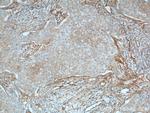 Vinculin Antibody in Immunohistochemistry (Paraffin) (IHC (P))