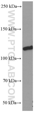 Vinculin Antibody in Western Blot (WB)