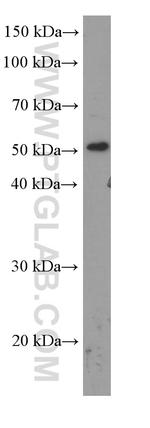 TBL2 Antibody in Western Blot (WB)