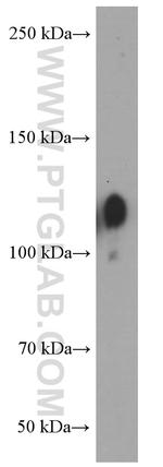 Integrin beta-1 Antibody in Western Blot (WB)
