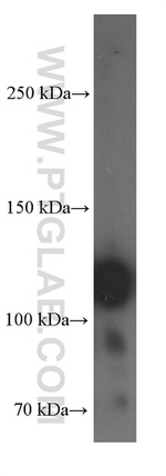 Integrin beta-1 Antibody in Western Blot (WB)