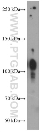 Integrin beta-1 Antibody in Western Blot (WB)