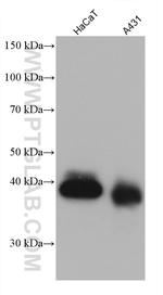 EPCAM Antibody in Western Blot (WB)