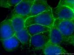 EPCAM Antibody in Immunocytochemistry (ICC/IF)