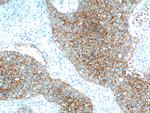 EPCAM Antibody in Immunohistochemistry (Paraffin) (IHC (P))