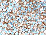 EPCAM Antibody in Immunohistochemistry (Paraffin) (IHC (P))