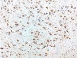 Peripherin Antibody in Immunohistochemistry (Paraffin) (IHC (P))