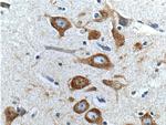 Peripherin Antibody in Immunohistochemistry (Paraffin) (IHC (P))