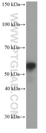 Peripherin Antibody in Western Blot (WB)