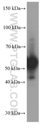 Peripherin Antibody in Western Blot (WB)