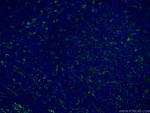 Fascin Antibody in Immunohistochemistry (PFA fixed) (IHC (PFA))