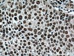 TRIM24 Antibody in Immunohistochemistry (Paraffin) (IHC (P))