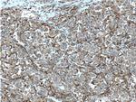 Factor XIIIa Antibody in Immunohistochemistry (Paraffin) (IHC (P))