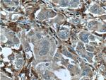 Factor XIIIa Antibody in Immunohistochemistry (Paraffin) (IHC (P))