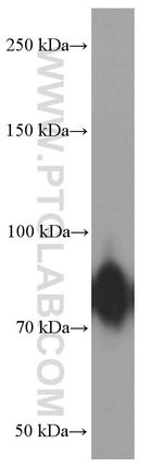 Factor XIIIa Antibody in Western Blot (WB)