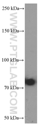 Factor XIIIa Antibody in Western Blot (WB)
