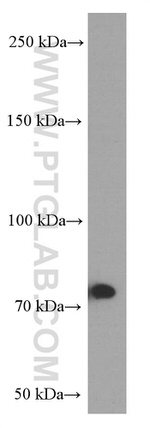 Factor XIIIa Antibody in Western Blot (WB)
