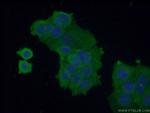 VPS37A Antibody in Immunocytochemistry (ICC/IF)