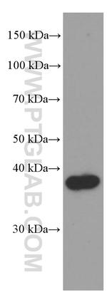 SFRP2 Antibody in Western Blot (WB)