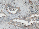 SMYD3 Antibody in Immunohistochemistry (Paraffin) (IHC (P))