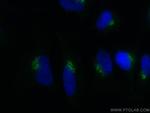 GP73/GOLPH2 Antibody in Immunocytochemistry (ICC/IF)