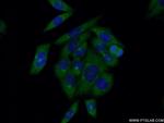 GP73/GOLPH2 Antibody in Immunocytochemistry (ICC/IF)
