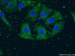 TH Antibody in Immunocytochemistry (ICC/IF)