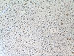 TH Antibody in Immunohistochemistry (Paraffin) (IHC (P))