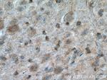 TH Antibody in Immunohistochemistry (Paraffin) (IHC (P))