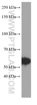 TH Antibody in Western Blot (WB)
