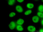 NUDT21 Antibody in Immunocytochemistry (ICC/IF)