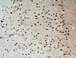 NUDT21 Antibody in Immunohistochemistry (Paraffin) (IHC (P))