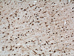 NUDT21 Antibody in Immunohistochemistry (Paraffin) (IHC (P))
