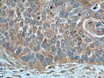 CRBN Antibody in Immunohistochemistry (Paraffin) (IHC (P))