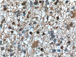 PHF10 Antibody in Immunohistochemistry (Paraffin) (IHC (P))