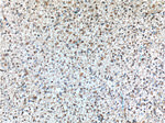 PHF10 Antibody in Immunohistochemistry (Paraffin) (IHC (P))