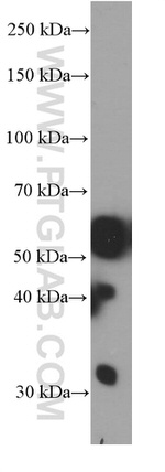 PHF10 Antibody in Western Blot (WB)